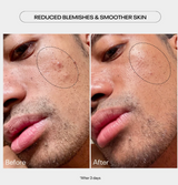 AHA previously known as Power Peel Refining Glycolic Acid Gel