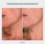 AHA previously known as Power Peel Refining Glycolic Acid Gel