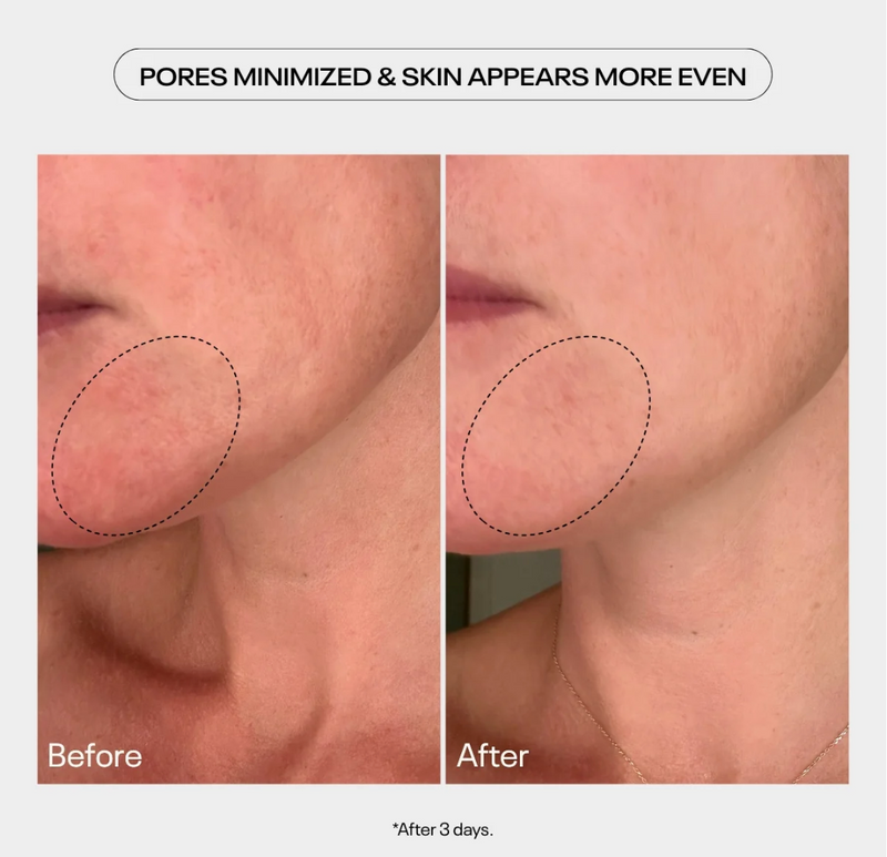 AHA previously known as Power Peel Refining Glycolic Acid Gel