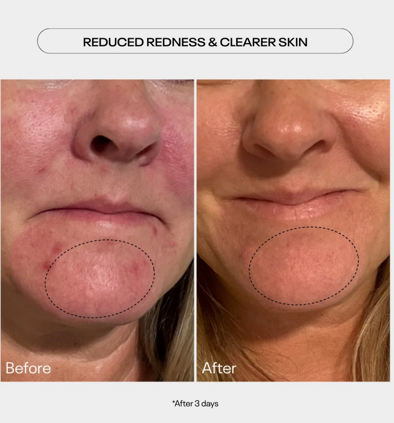 AHA previously known as Power Peel Refining Glycolic Acid Gel